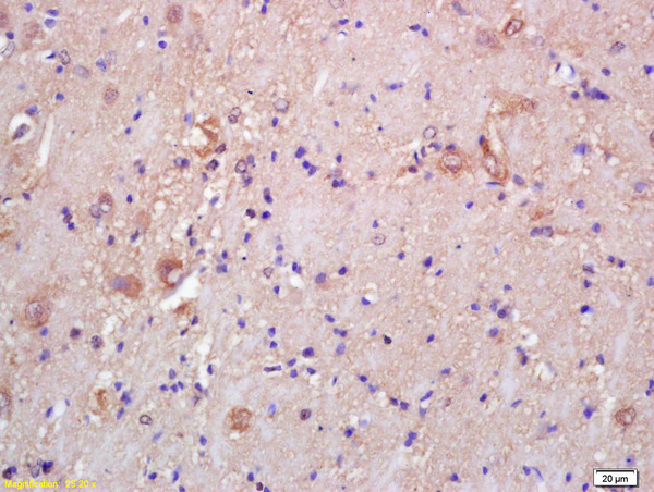 Formalin-fixed and paraffin embedded rat brain labeled with Rabbit Anti CKMT/Creatine kinase MT Polyclonal Antibody, Unconjugated (bs-6522R) at 1:200 followed by conjugation to the secondary antibody and DAB staining