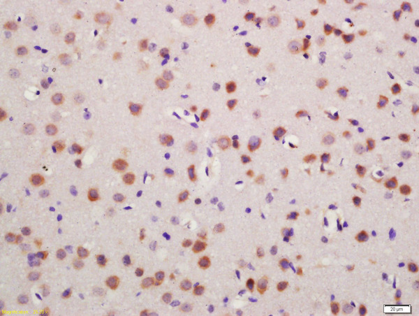 Formalin-fixed and paraffin embedded mouse brain labeled with Rabbit Anti-Glutamine synthetase Polyclonal Antibody, Unconjugated (bs-4143R) at 1:200 followed by conjugation to the secondary antibody and DAB staining\n