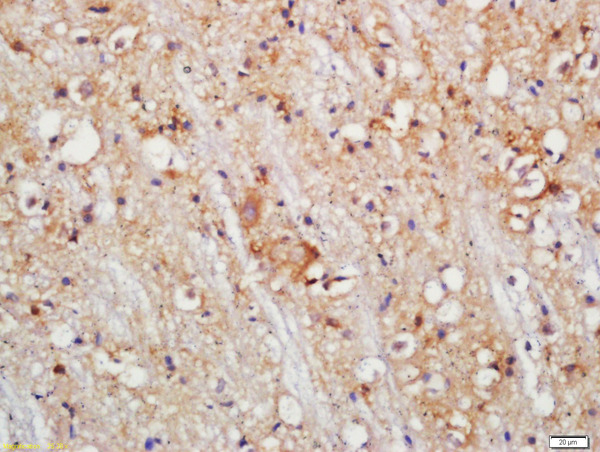 Formalin-fixed and paraffin embedded mouse brain labeled with Rabbit Anti-PLDL1 Polyclonal Antibody, Unconjugated (bs-4151R) at 1:200 followed by conjugation to the secondary antibody and DAB staining