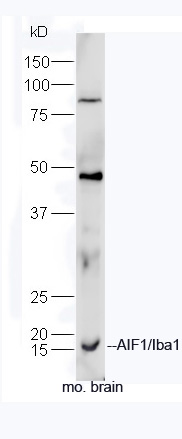 Formalin-fixed and paraffin embedded rat brain tissue labeled with Anti-AIF1 Polyclonal Antibody, unonjugated (bs-1363R) at 1:200 for 40 minutes at 37°C followed by labeling Goat Anti-Rabbit IgG, Cy3 conjugated(bs-0295G-Cy3) 1:200, 40 minutes at 37°C