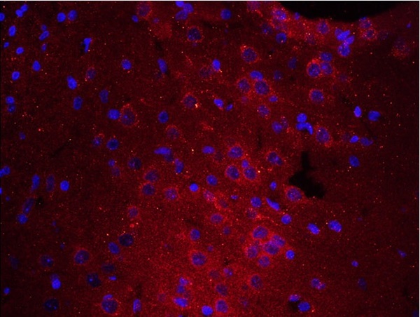 Formalin-fixed and paraffin embedded rat brain tissue labeled with Anti-PTPRA Polyclonal Antibody, unconjugated (bs-4154R) at 1:200 for 40 minutes at 37°C followed by labeling Rabbit Anti-Tubulin Beta, Cy3 conjugated(bs-4511R-Cy3) 1:200, 40 minutes at 37°C.