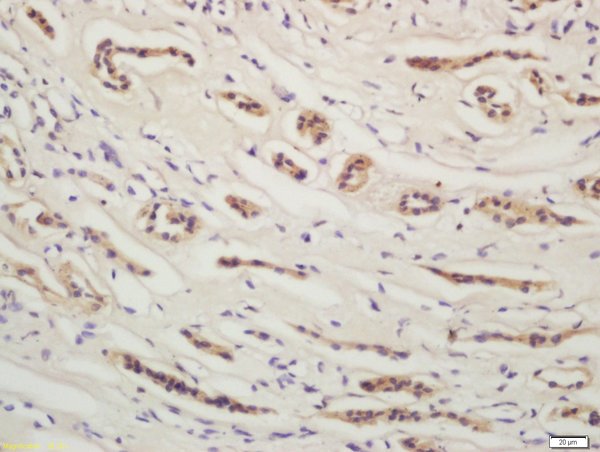 Formalin-fixed and paraffin embedded human kidney labeled with Rabbit Anti-YES1 Polyclonal Antibody, Unconjugated (bs-4166R) at 1:200 followed by conjugation to the secondary antibody and DAB staining\n