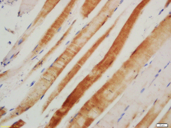 Formalin-fixed and paraffin embedded rat skeletal muscle labeled with Rabbit Anti-AGER Polyclonal Antibody, Unconjugated (bs-4999R) at 1:200 followed by conjugation to the secondary antibody and DAB staining\n