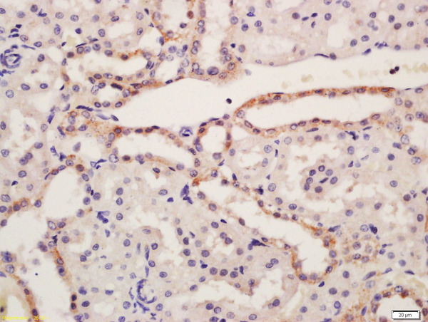 Formalin-fixed and paraffin embedded rat kidney tissue labeled with Rabbit Anti-NALP6 Polyclonal Antibody, Unconjugated (bs-10440R) at 1:200 followed by conjugation to the secondary antibody and DAB staining