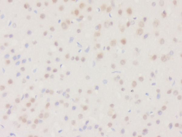 Formalin-fixed and paraffin embedded rat brain tissue labeled with Rabbit Anti-DHRS2 Polyclonal Antibody, Unconjugated (bs-10771R) at 1:200 followed by conjugation to the secondary antibody and DAB staining