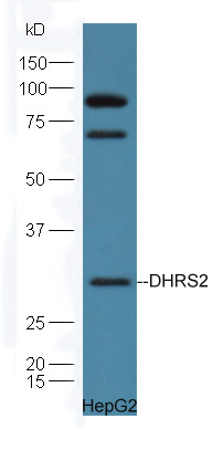 HepG2 cell lysates probed with Rabbit Anti-DHRS2 Polyclonal Antibody, Unconjugated (bs-10771R) at 1:300 in 4˚C. Followed by conjugation to secondary antibody (bs-0295G-HRP) at 1:5000 for 90min at 37˚C.