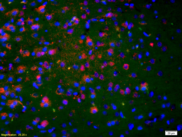 Formalin-fixed and paraffin-embedded rat brain labeled with Anti-NKA/Neurokinin A Polyclonal Antibody, Unconjugated(bs-0069R) 1:200, overnight at 4°C, The secondary antibody was Goat Anti-Rabbit IgG, Cy3 conjugated(bs-0295G-Cy3)used at 1:200 dilution for 40 minutes at 37°C.