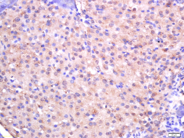 Formalin-fixed and paraffin embedded rat pancreas tissue labeled with Rabbit Anti-CTDSP2 Polyclonal Antibody, Unconjugated (bs-14099R) at 1:200 followed by conjugation to the secondary antibody and DAB staining