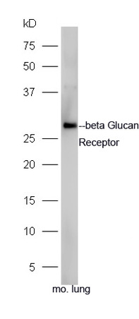 Mouse lung lysates probed with Rabbit Anti-Beta Glucan Receptor Polyclonal Antibody, Unconjugated (bs-2455R) at 1:300 overnight at 4˚C. Followed by a conjugated secondary antibody (bs-0295G-HRP) at 1:5000 for 90 min at 37˚C.