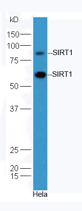Hela cell lysates probed with Anti-SIRT1 Polyclonal Antibody, Unconjugated (bs-0921R) at 1:300 in 4˚C. Followed by conjugation to secondary antibody (bs-0295G-HRP) at 1:3000 90min in 37˚C.