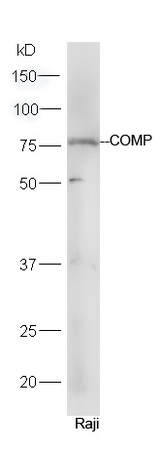 Raji cell lysates probed with Rabbit Anti-COMP Polyclonal Antibody, Unconjugated (bs-10286R) at 1:300 in 4˚C. Followed by conjugation to secondary antibody (bs-0295G-HRP) at 1:5000 for 90min at 37˚C.