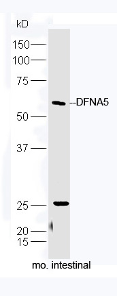 Mouse intestinal lysate probed with Rabbit Anti-DFNA5 Polyclonal Antibody, Unconjugated (bs-14286R) at 1:300 in 4˚C. Followed by conjugation to secondary antibody (bs-0295G-HRP) at 1:5000 for 90min at 37˚C.