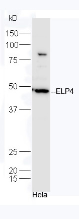 HeLa cell lysates probed with Rabbit Anti-ELP4 Polyclonal Antibody, Unconjugated (bs-14574R) at 1:300 in 4˚C. Followed by conjugation to secondary antibody (bs-0295G-HRP) at 1:5000 for 90min at 37˚C.