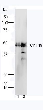 Line1, mouse heart lysate; Line2, mouse liver lysate probed with Rabbit Anti-CYT19 Polyclonal Antibody, Unconjugated (bs-10633R) at 1:300 in 4˚C. Followed by conjugation to secondary antibody (bs-0295G-HRP) at 1:5000 for 90min at 37˚C.