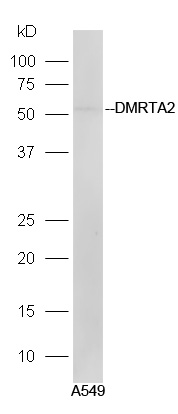 A549 lysates probed with Rabbit Anti-DMRTA2 Polyclonal Antibody, Unconjugated (bs-14348R) at 1:300 in 4˚C. Followed by conjugation to secondary antibody (bs-0295G-HRP) at 1:5000 for 90min at 37˚C.
