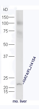 Mouse liver lysate probed with Rabbit Anti-HAT4 Polyclonal Antibody, Unconjugated (bs-16106R) at 1:300 in 4˚C. Followed by conjugation to secondary antibody (bs-0295G-HRP) at 1:5000 for 90min at 37˚C.