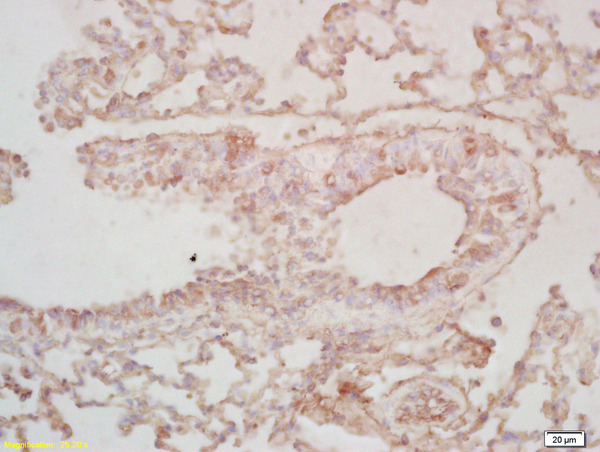 Formalin-fixed and paraffin embedded mouse lung labeled with Rabbit Anti BCAS2 Polyclonal Antibody, Unconjugated (bs-6610R) at 1:200 followed by conjugation to the secondary antibody and DAB staining