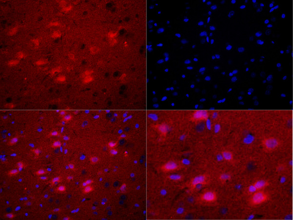 Formalin-fixed and paraffin embedded rat brain labeled with Rabbit Anti-Bax (Ser184) Polyclonal Antibody, Unconjugated (bs-3010R) at 1:200 followed by Goat Anti-Rabbit IgG, Cy3 conjugated(bs-0295G-Cy3)used at 1:200 dilution for 40 minutes at 37\u00b0C. DAPI was used to stain the cell nuclei\\n