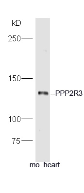 Mouse heart lysates probed with Rabbit Anti-PPP2R3 Polyclonal Antibody, Unconjugated (bs-5759R) at 1:300 overnight at 4˚C. Followed by a conjugated secondary antibody (bs-0295G-HRP) at 1:5000 for 90 min at 37˚C.