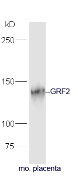 Mouse placenta lysate probed with Rabbit Anti-GRF2 Polyclonal Antibody, Unconjugated (bs-16311R) at 1:300 in 4˚C. Followed by conjugation to secondary antibody (bs-0295G-HRP) at 1:5000 for 90min at 37˚C.
