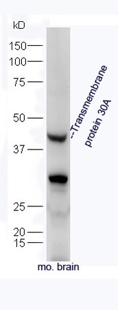 Mouse brain lysate probed with Rabbit Anti-Transmembrane Protein 30A Polyclonal Antibody, Unconjugated (bs-16576R) at 1:300 in 4˚C. Followed by conjugation to secondary antibody (bs-0295G-HRP) at 1:5000 for 90min at 37˚C.