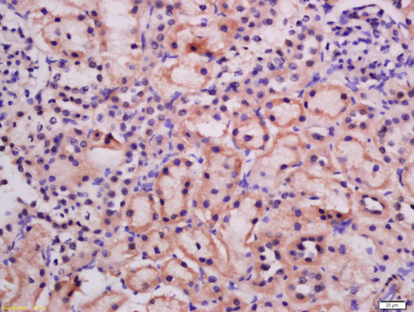 Formalin-fixed and paraffin embedded rat kidney labeled with Rabbit Anti-ATG9A Polyclonal Antibody, Unconjugated (bs-4010R) at 1:200 followed by conjugation to the secondary antibody and DAB staining\\n