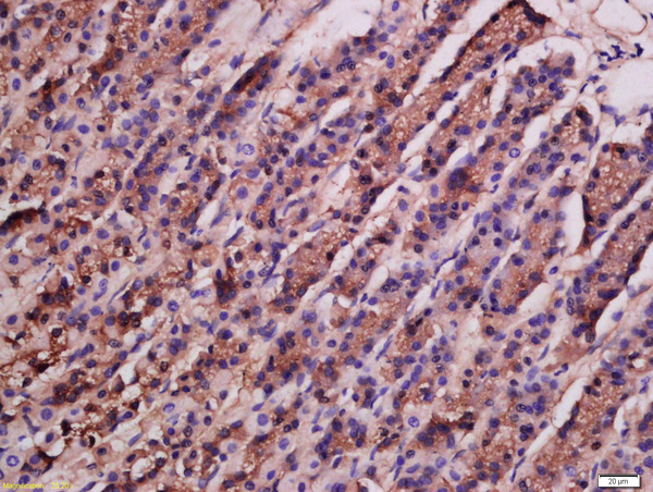 Formalin-fixed and paraffin embedded rat stomach labeled with Rabbit Anti-ATG9A Polyclonal Antibody, Unconjugated (bs-4010R) at 1:200 followed by conjugation to the secondary antibody and DAB staining\\n