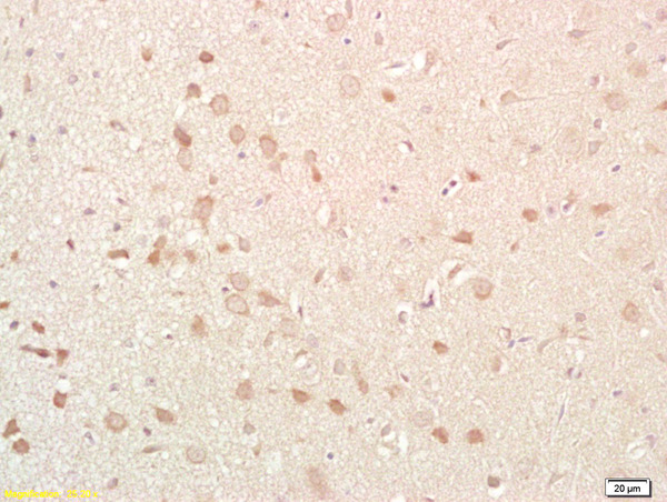 Formalin-fixed and paraffin embedded rat brain labeled with Anti-NKB Polyclonal Antibody, Unconjugated (bs-0070R) at 1:200 followed by conjugation to the secondary antibody and DAB staining