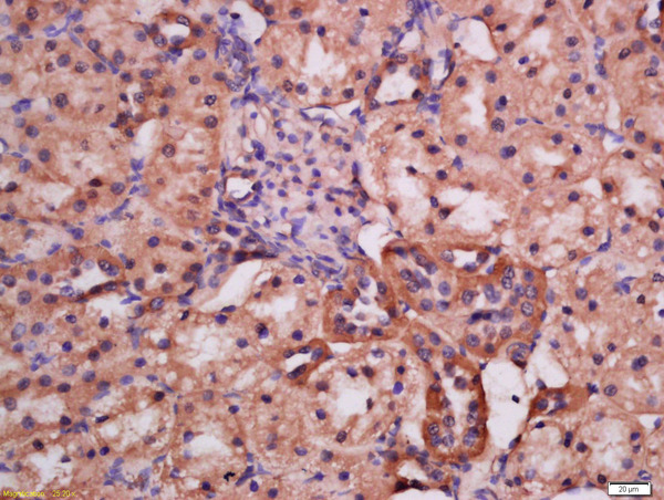 Formalin-fixed and paraffin embedded rat kidney labeled with Rabbit Anti-ATG9A(Ser735) Polyclonal Antibody, Unconjugated (bs-5199R) at 1:200 followed by conjugation to the secondary antibody and DAB staining\\n