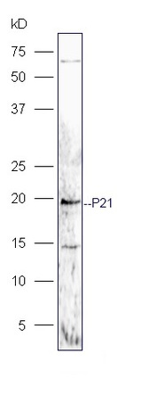 Human MG-63 lysates probed with Rabbit Anti-P21 Polyclonal Antibody, Unconjugated (bs-10129R) at 1:300 overnight at 4˚C. Followed by a conjugated secondary antibody (bs-0295G-HRP) at 1:5000 for 90 min at 37˚C.