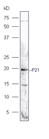 Human MG-63 lysates probed with Rabbit Anti-P21 Polyclonal Antibody, Unconjugated (bs-10129R) at 1:300 overnight at 4˚C. Followed by a conjugated secondary antibody (bs-0295G-HRP) at 1:5000 for 90 min at 37˚C. Human MG-63 lysates probed with Rabbit Anti-P21 Polyclonal Antibody, Unconjugated (bs-10129R) at 1:300 overnight at 4˚C. Followed by a conjugated secondary antibody (bs-0295G-HRP) at 1:5000 for 90 min at 37˚C.