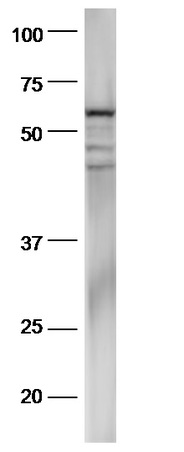 Mouse stomach lysates probed with Anti-pan-Cytokeratin Polyclonal Antibody, Unconjugated (bs-2190R) at 1:300 in 4˚C. Followed by conjugation to secondary antibody (bs-0295G-HRP) at 1:5000 90min in 37˚C.