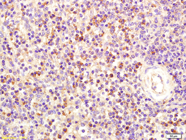 Formalin-fixed and paraffin embedded human spleen tissue labeled with Rabbit Anti-FCER1A Polyclonal Antibody (bs-8514R) at 1:200 followed by conjugation to the secondary antibody and DAB staining