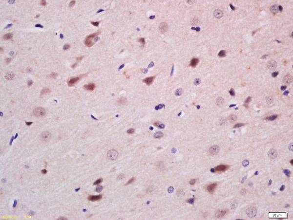 paraformaldehyde-fixed, paraffin embedded rat brain tissue; Antigen retrieval with 0.4% pepsin at 37°C for 30min; Block endogenous peroxidase by 3% hydrogen peroxide for 30 minutes; Blocking buffer (normal goat serum) at 37°C for 20min; Antibody incubation with Rabbit Anti-Neurogenin 3 Polyclonal Antibody, Unconjugated (bs-0922R) at 1:200 overnight at 4°C, followed by a conjugated secondary and DAB staining