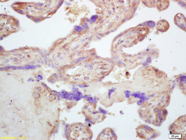 Formalin-fixed and paraffin embedded human placenta labeled with Rabbit Anti CARD4 Polyclonal Antibody, Unconjugated (bs-7085R) at 1:200 followed by conjugation to the secondary antibody and DAB staining