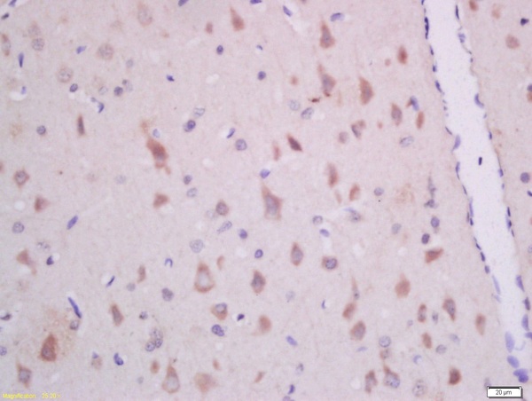 Formalin-fixed and paraffin embedded rat brain labeled with Anti-GHRH Polyclonal Antibody (bs-0205R) at 1:300 followed by conjugation to the secondary antibody and DAB staining.
