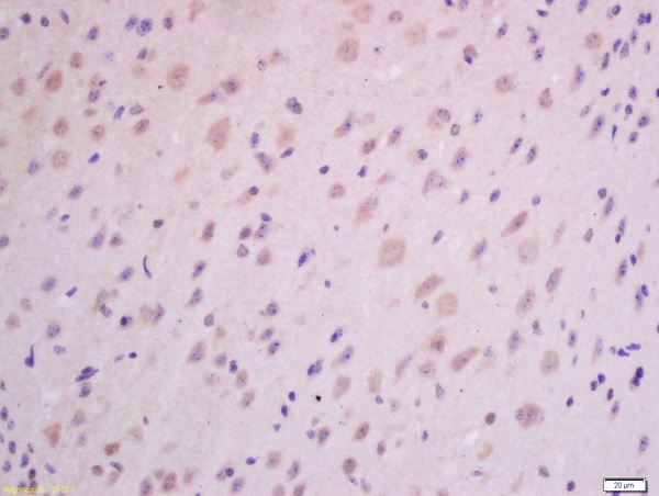 Formalin-fixed and paraffin embedded mouse brain labeled with Anti-GHRH Polyclonal Antibody, Unconjugated (bs-0205R) at 1:300 followed by conjugation to the secondary antibody (bs-0295G-HRP) and DAB staining.
