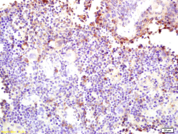 Formalin-fixed and paraffin embedded mouse spleen labeled with Rabbit Anti CARD4 Polyclonal Antibody, Unconjugated (bs-7085R) at 1:200 followed by conjugation to the secondary antibody and DAB staining