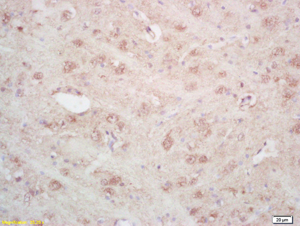 Formalin-fixed and paraffin embedded rat brain labeled with Rabbit Anti ARTS Polyclonal Antibody, Unconjugated (bs-7096R) at 1:200 followed by conjugation to the secondary antibody and DAB staining