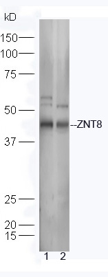 Lane 1: Human Raji lysates; Lane 2: Mouse spleen lysates probed with Rabbit Anti-ZNT8 Polyclonal Antibody, Unconjugated (bs-15382R) at 1:300 overnight at 4˚C. Followed by a conjugated secondary antibody (bs-0295G-HRP) at 1:5000 for 90 min at 37˚C. Lane 1: Human Raji lysates; Lane 2: Mouse spleen lysates probed with Rabbit Anti-ZNT8 Polyclonal Antibody, Unconjugated (bs-15382R) at 1:300 overnight at 4˚C. Followed by a conjugated secondary antibody (bs-0295G-HRP) at 1:5000 for 90 min at 37˚C.