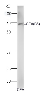 Human CEA lysates probed with Mouse Anti-CEA (B5) Monoclonal Antibody, Unconjugated (bsm-1624M) at 1:300 overnight at 4˚C. Followed by a conjugated secondary antibody (bs-0295G-HRP) at 1:5000 for 90 min at 37˚C.
