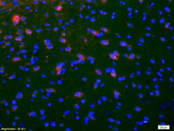 Formalin-fixed and paraffin-embedded rat brain labeled with Anti-NKB Polyclonal Antibody, Unconjugated(bs-0070R) 1:200, overnight at 4°C, The secondary antibody was Goat Anti-Rabbit IgG,Cy3 conjugated(bs-0295G-Cy3)used at 1:200 dilution for 40 minutes at 37°C.