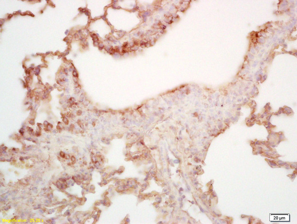 Formalin-fixed and paraffin embedded mouse lung labeled with Rabbit Anti MAL2 Polyclonal Antibody, Unconjugated (bs-7175R) at 1:200 followed by conjugation to the secondary antibody and DAB staining Formalin-fixed and paraffin embedded mouse lung labeled with Rabbit Anti MAL2 Polyclonal Antibody, Unconjugated (bs-7175R) at 1:200 followed by conjugation to the secondary antibody and DAB staining