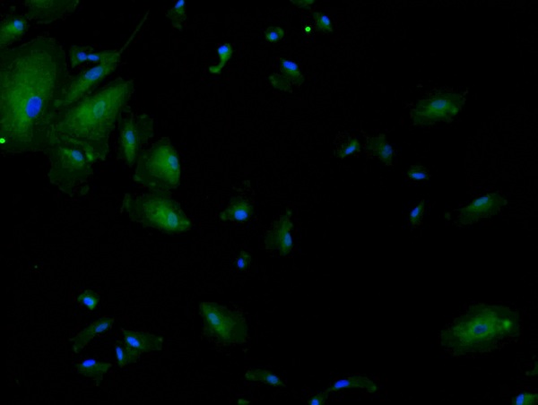 PFA fixed A549 cells with Anti-TTF1 Polyclonal Antibody (bs-0826R) at 1:200 dilution, followed by conjugation to the secondary, Goat Anti-Rabbit IgG A488 1:100 for 30min. This data was generously submitted by an end user as part of our Bioss Discovery program.