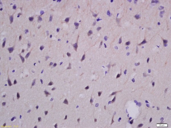 Formalin-fixed and paraffin embedded rat brain labeled with Rabbit Anti-EphA2 Polyclonal Antibody, Unconjugated (bs-0485R) at 1:100 followed by conjugation to the secondary antibody and DAB staining\\n