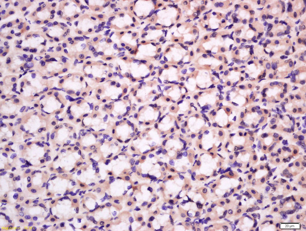 Formalin-fixed and paraffin embedded rat stomach tissue labeled with Anti-BK channel Polyclonal Antibody, Unconjugated(bs-0729R) 1:300 followed by conjugation to the secondary antibody and DAB staining.