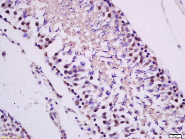 Formalin-fixed and paraffin embedded rat Testis tissue labeled with Anti-PKC epsilon Polyclonal Antibody, Unconjugated(bs-2329R) 1:300 followed by conjugation to the secondary antibody and DAB staining