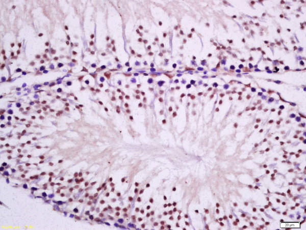 Formalin-fixed and paraffin embedded rat testis tissue labeled with Anti-PKC epsilon Polyclonal Antibody, Unconjugated(bs-2329R) 1:300 followed by conjugation to the secondary antibody and DAB staining.