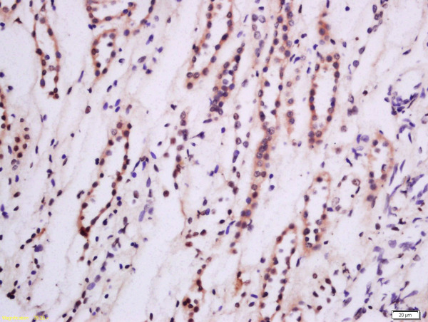 Formalin-fixed and paraffin embedded Human kidney tissue labeled with Anti-PKC epsilon Polyclonal Antibody, Unconjugated(bs-2329R) 1:200 followed by conjugation to the secondary antibody and DAB staining