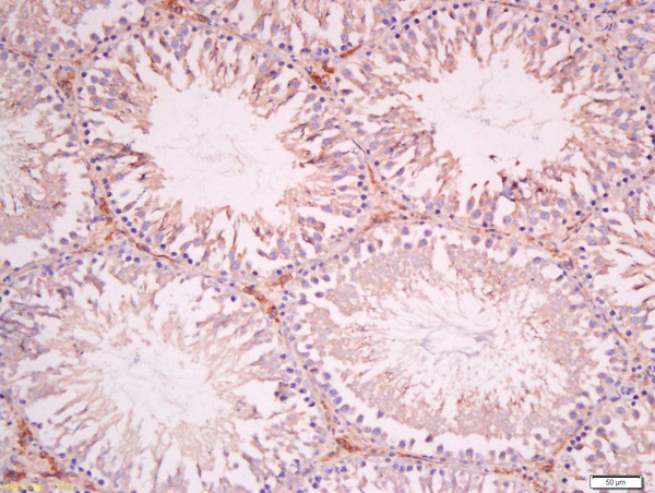 Formalin-fixed and paraffin embedded rat testis tissue labeled with Anti-SOAT1 Polyclonal Antibody, Unconjugated(bs-7544R) 1:400 followed by conjugation to the secondary antibody and DAB staining.